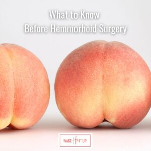 hemmorhoid surgery