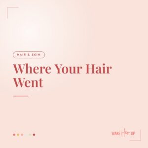 Perimenopause hair loss and thinning